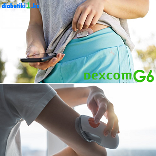 Dexcom G6: Трансформация управления диабетом